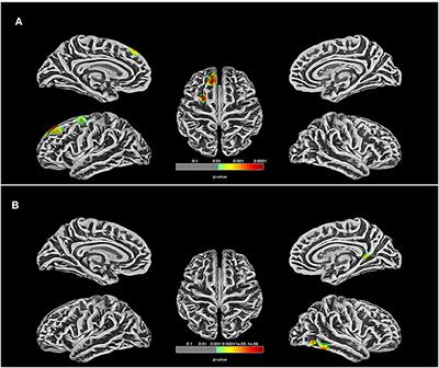 Changes in Cortical Thickness Are Associated With Cognitive Ability in Postoperative School-Aged Children With Tetralogy of Fallot